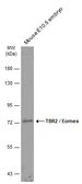 Anti-TBR2 / Eomes antibody used in Western Blot (WB). GTX134088